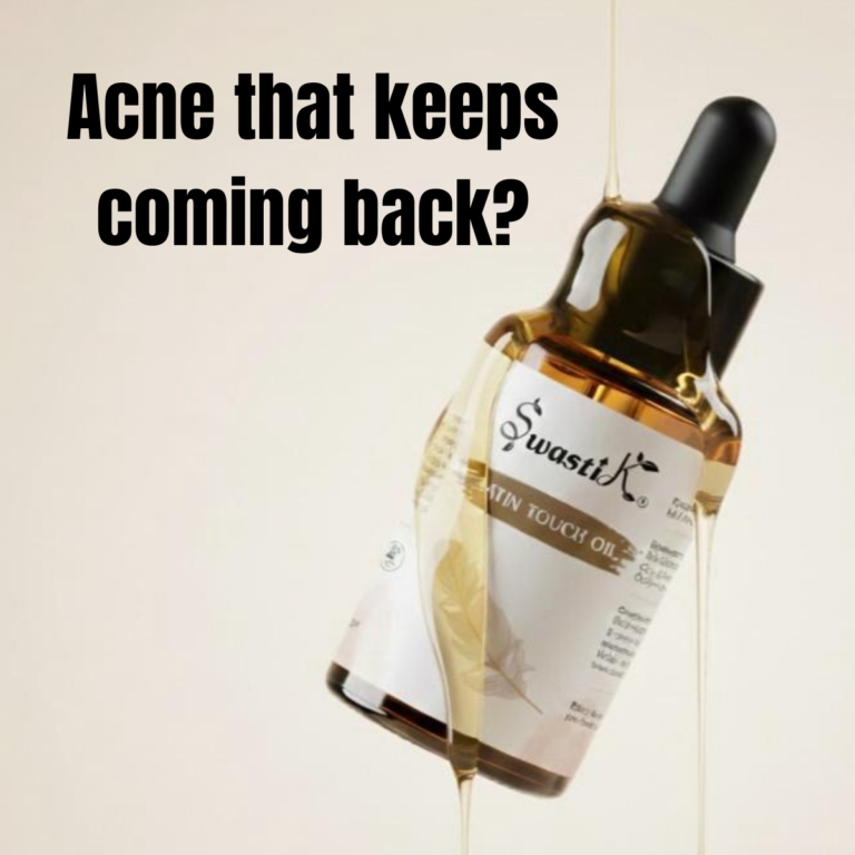 Acne That keeps coming Back?