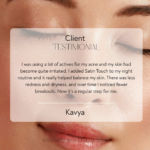 Customer testimonial for Satin Touch acne oil showing reduced breakouts, less redness and improved skin balance