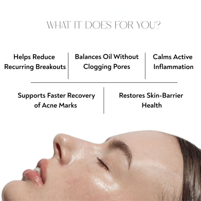 Benefits of Satin Touch acne oil including reducing pimples, balancing oil, calming inflammation and improving skin barrier