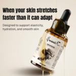 Swastik SPOT-LESS stretch marks oil bottle with dropper, designed to support skin elasticity and hydration during pregnancy