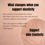 Visual explaining how lack of elasticity causes stretch marks and why supporting skin during stretching helps prevent them