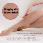 Image showing visible veins and leg discomfort caused by poor circulation leading to heaviness and cramps