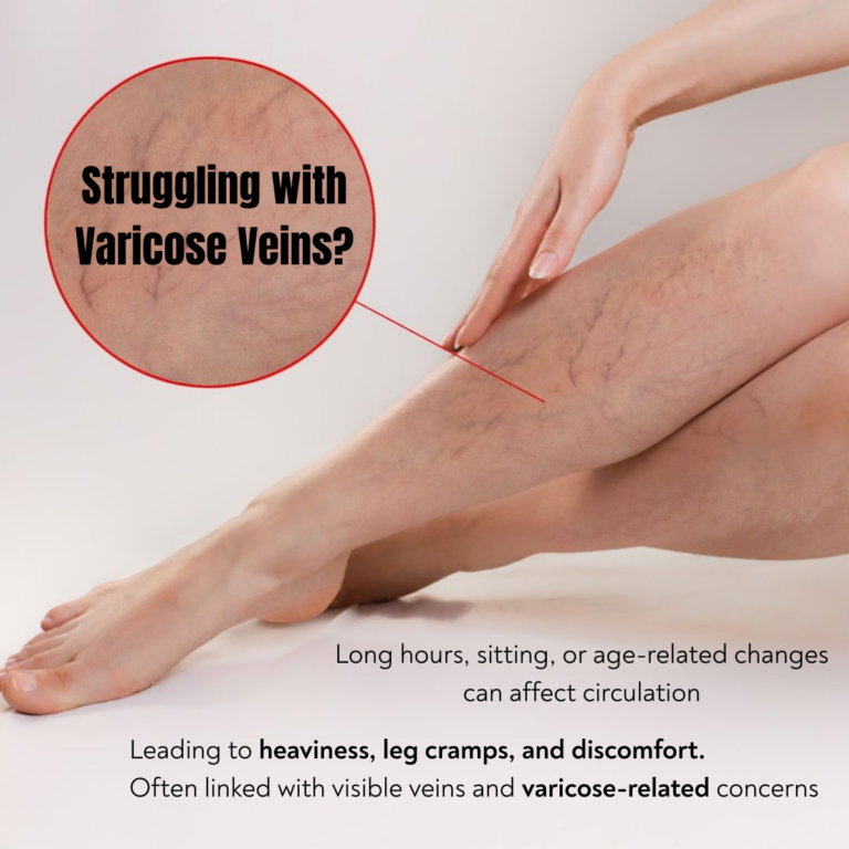 Image showing visible veins and leg discomfort caused by poor circulation leading to heaviness and cramps