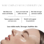 before after skin improvement smoother texture reduced stretch marks and scars wheatgerm oil results