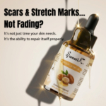 Wheatgerm oil bottle for scars and stretch marks with headline not fading skin repair oil India