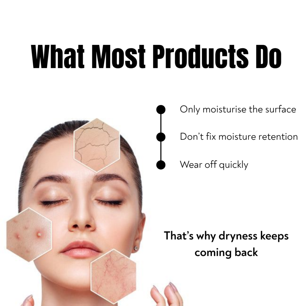 Woman face with dry skin patches showing how most skincare products only moisturise surface and fail long term