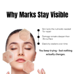 skin damage scars stretch marks explanation why marks stay visible skin lacks repair nutrients