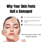 dull damaged skin caused by slow skin repair uneven texture and rough skin explained