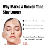 uneven skin tone acne marks and dull skin caused by slow skin renewal process