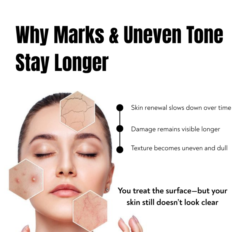 uneven skin tone acne marks and dull skin caused by slow skin renewal process